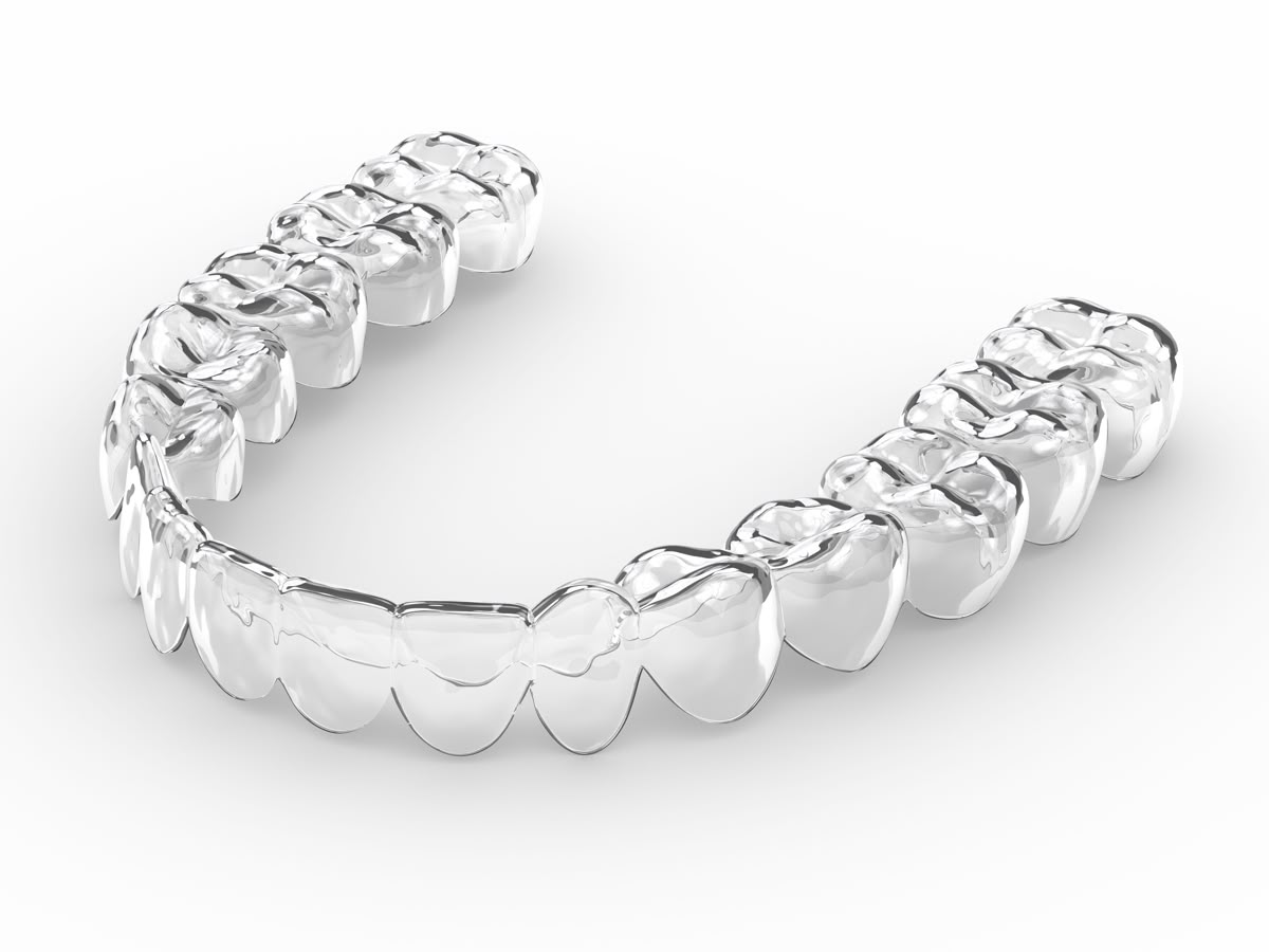 Niềng răng invisalign